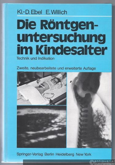  - Die Röntgenuntersuchung im Kindesalter. Technik und Indikation. Unter Berücksichtigung der Nuklearmedizin und der kranialen Computertomographie.