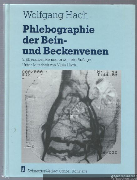  - Phlebographie der Bein- und Beckenvenen.
